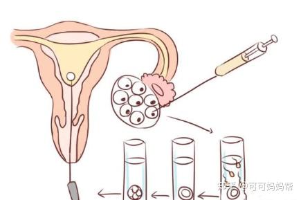 孕期子宫大小变化